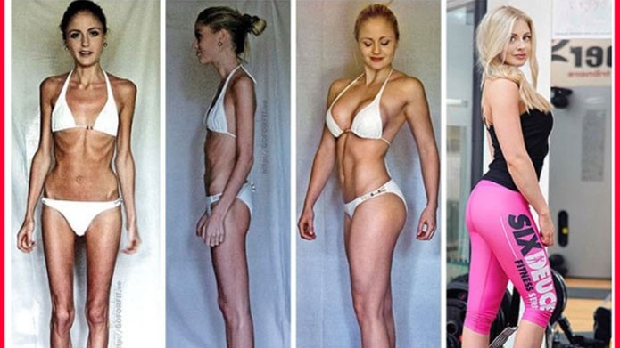 15 fotos del antes y después de personas que superaron la anorexia ¡Se ven mucho mejor!
